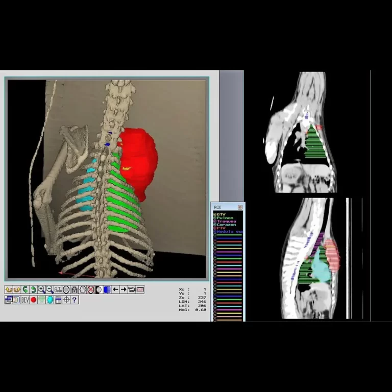 Radioterapia veterinaria